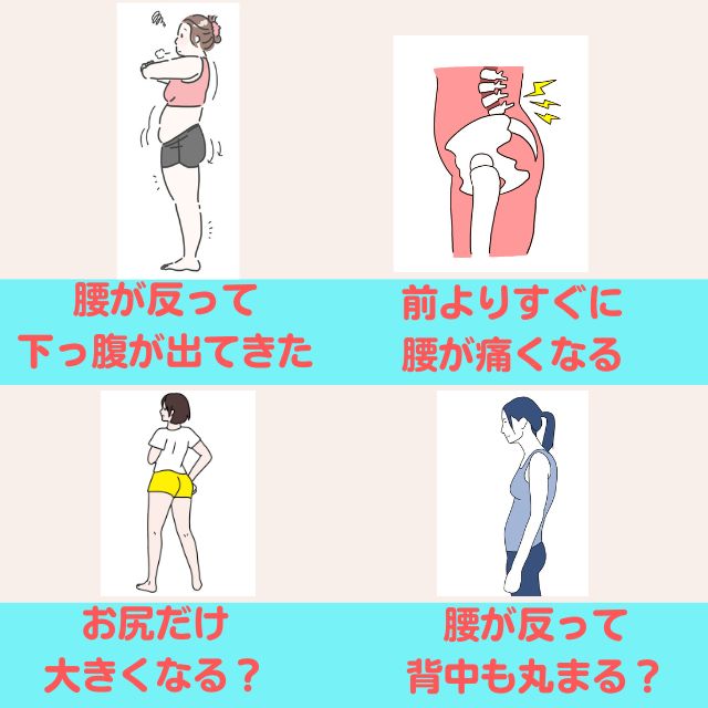反り腰症状