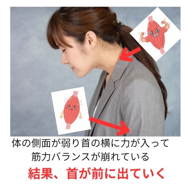 ストレートネックさぼり筋