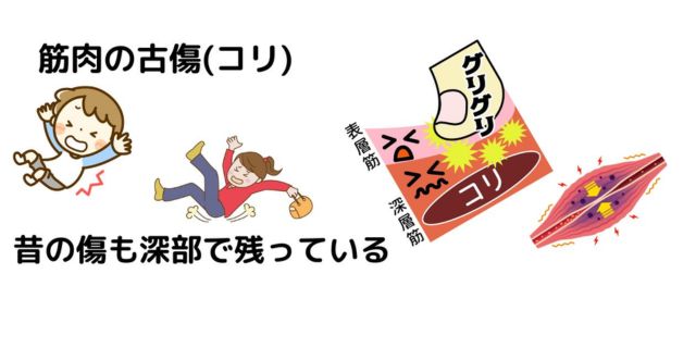 コリ