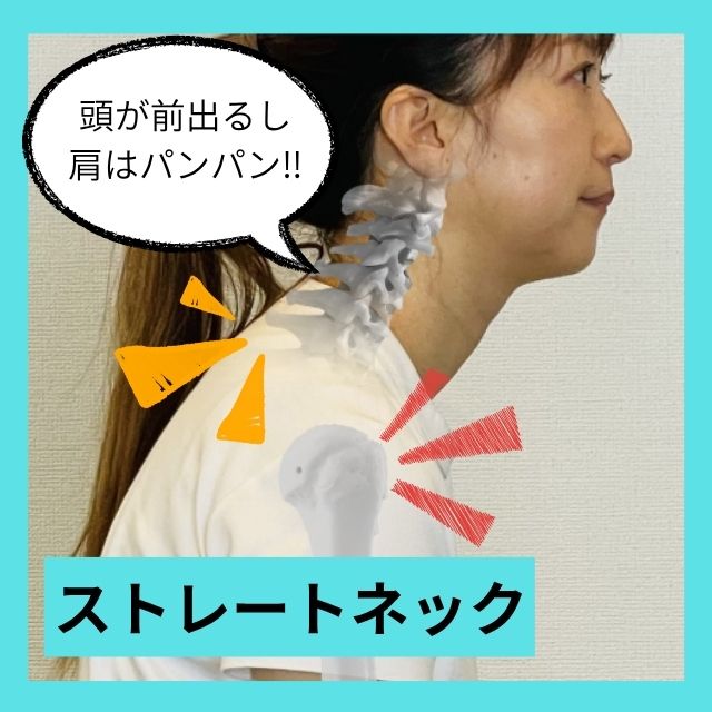 ストレートネック